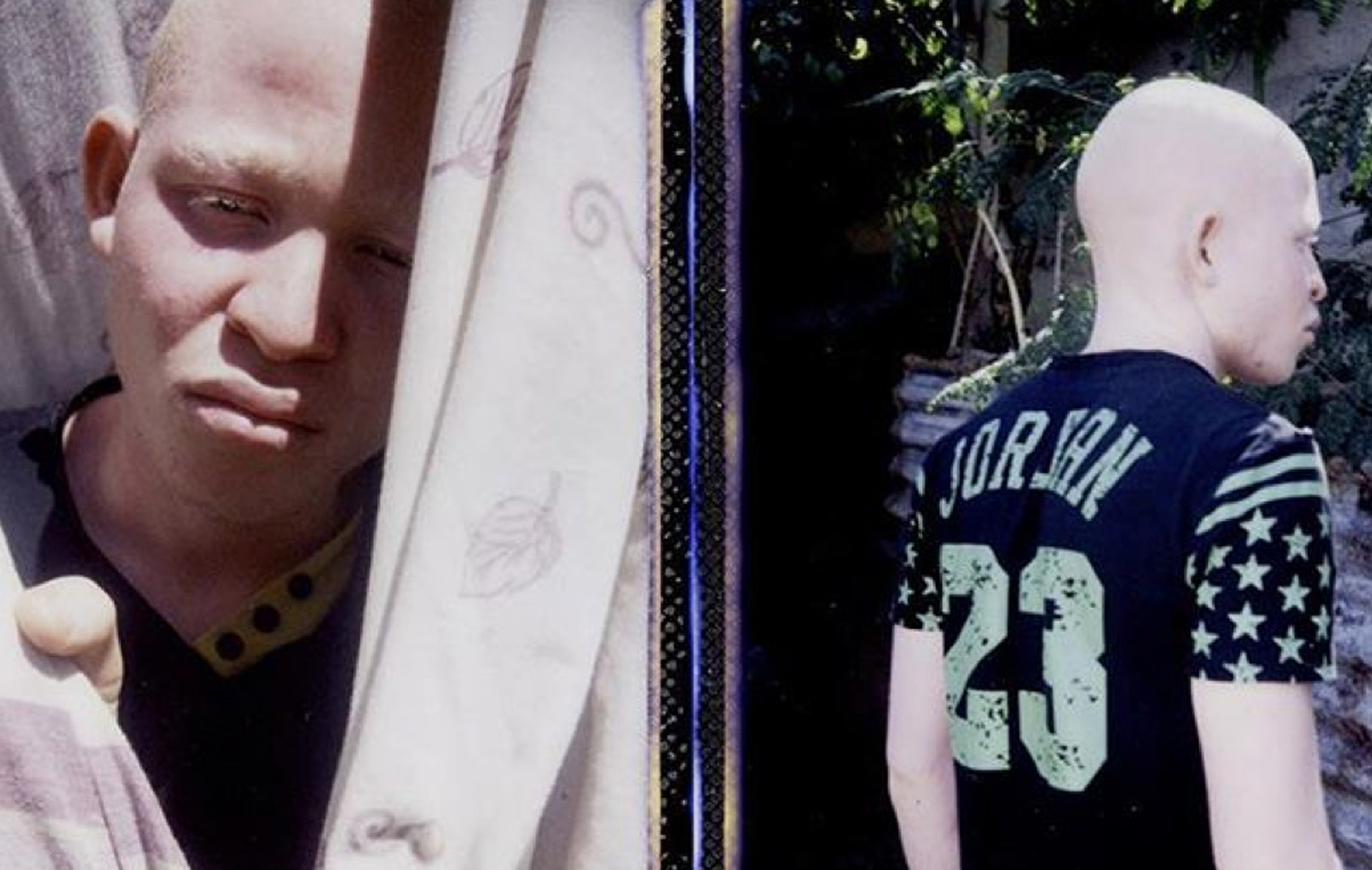 Projekt dokumentalny o afrykańskich albinosach – pomóżmy go zrealizować!