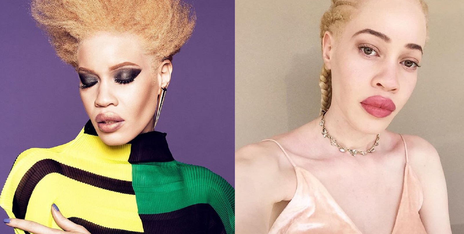 Pierwsza modelka-albinoska w kampanii beauty!