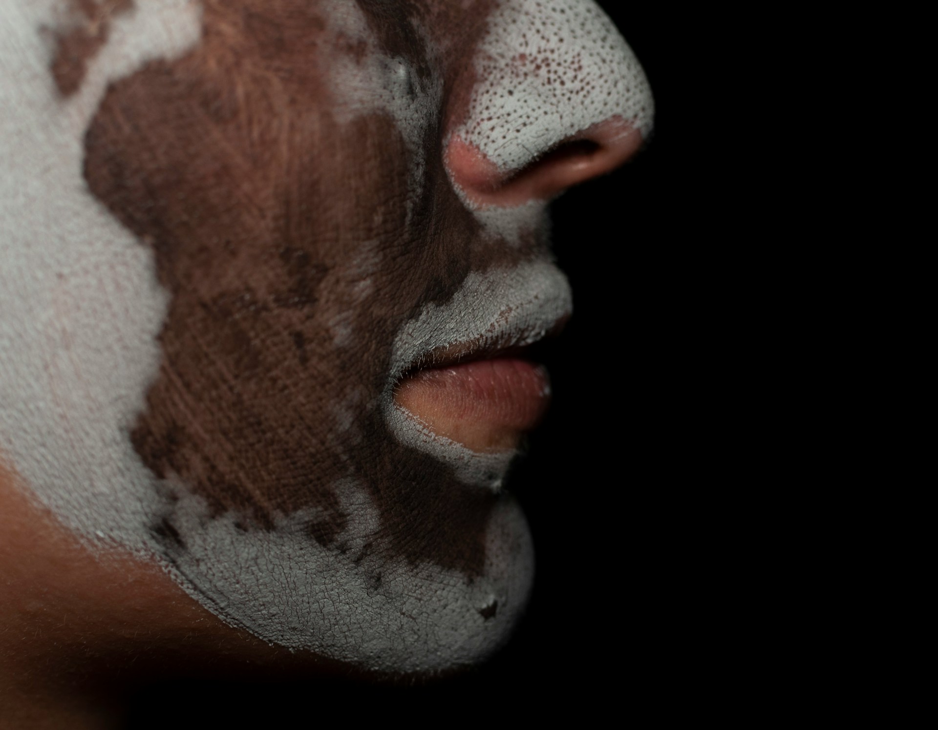 Peelingi chemiczne na&nbsp;zimę – skuteczna odnowa skóry w&nbsp;chłodnych miesiącach